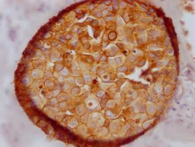 Immunohistochemistry: E-Cadherin Antibody (1E1) [NBP3-15180]