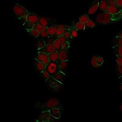 Immunocytochemistry/ Immunofluorescence: E-Cadherin Antibody (4A2) - Azide and BSA Free [NBP2-54587]