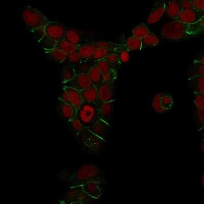 Immunocytochemistry/ Immunofluorescence: E-Cadherin Antibody (4A2) [NBP2-53229]
