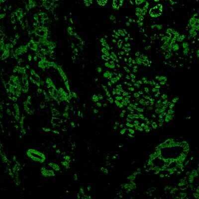Immunohistochemistry: E-Cadherin Antibody (4A2) [NBP2-53229]