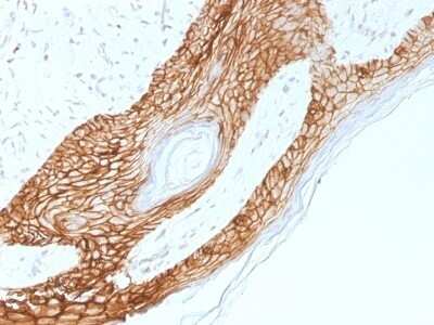 Immunohistochemistry-Paraffin: E-Cadherin Antibody (4A2) [NBP2-53229]