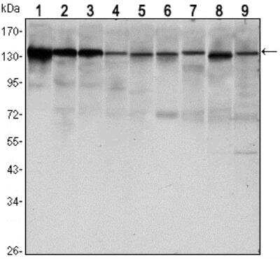 Western Blot: E-Cadherin Antibody (7H12)BSA Free [NBP2-19051]