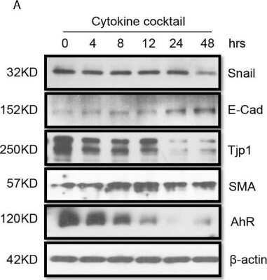 Western Blot: E-Cadherin Antibody (7H12)BSA Free [NBP2-19051]