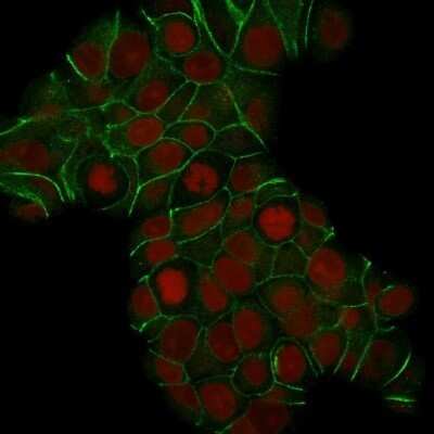 Immunocytochemistry/ Immunofluorescence: E-Cadherin Antibody (CDH1/1525) - Azide and BSA Free [NBP2-54551]