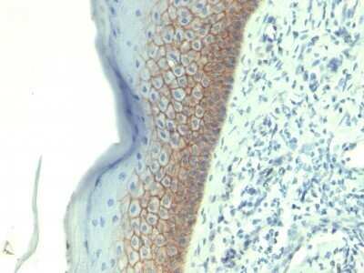 Immunohistochemistry-Paraffin: E-Cadherin Antibody (CDH1/1525) - Azide and BSA Free [NBP2-54551]
