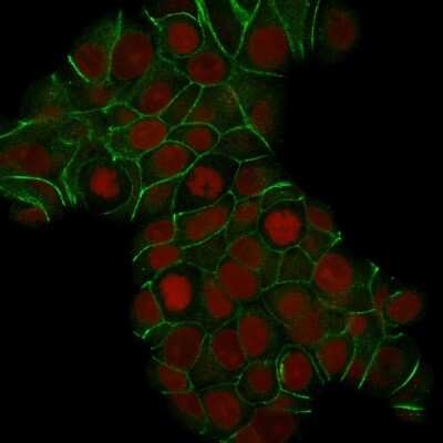 Immunocytochemistry/ Immunofluorescence: E-Cadherin Antibody (CDH1/1525) [NBP2-53354]