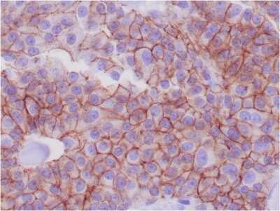 Immunohistochemistry-Paraffin: E-Cadherin Antibody (CDH1/1525) [NBP2-53354]