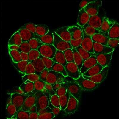Immunocytochemistry/ Immunofluorescence: E-Cadherin Antibody (CDH1/2208R) - Azide and BSA Free [NBP3-07903]