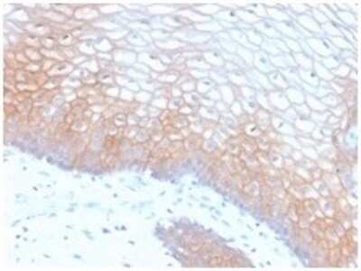 Immunohistochemistry-Paraffin: E-Cadherin Antibody (CDH1/2208R) - Azide and BSA Free [NBP3-07903]