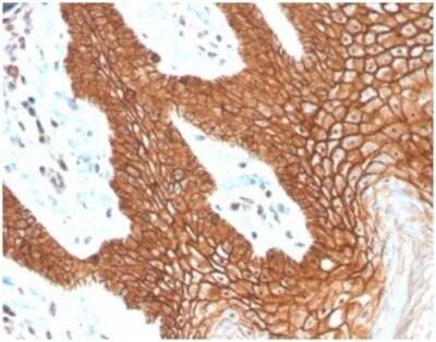 Immunohistochemistry-Paraffin: E-Cadherin Antibody (CDH1/4398R) - Azide and BSA Free [NBP3-09082]