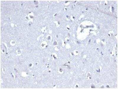 Immunohistochemistry-Paraffin: E-Cadherin Antibody (CDH1/4398R) [NBP3-11401]