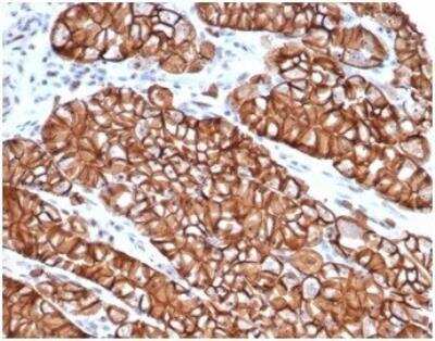 Immunohistochemistry-Paraffin: E-Cadherin Antibody (CDH1/4398R) [NBP3-11401]