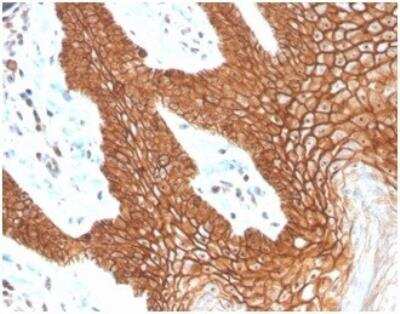 Immunohistochemistry-Paraffin: E-Cadherin Antibody (CDH1/4398R) [NBP3-11401]