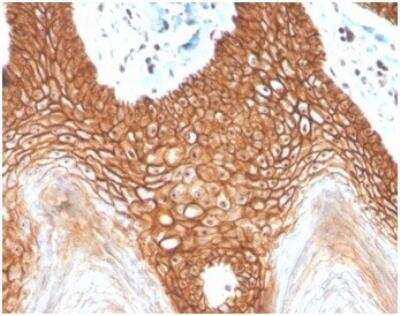 Immunohistochemistry-Paraffin: E-Cadherin Antibody (CDH1/4398R) [NBP3-11401]