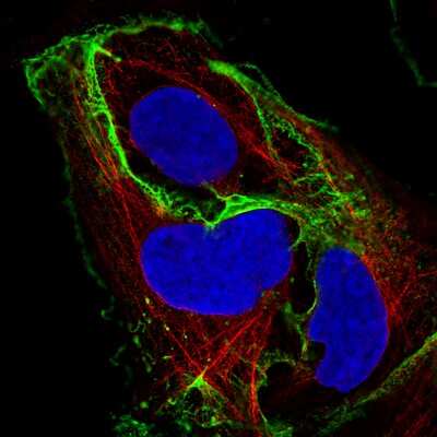 Immunocytochemistry/ Immunofluorescence: E-Cadherin Antibody (CL1170) [NBP2-34475]