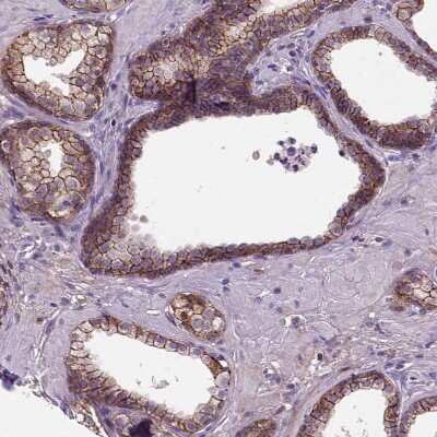 Immunohistochemistry-Paraffin: E-Cadherin Antibody (CL1170) [NBP2-34475]