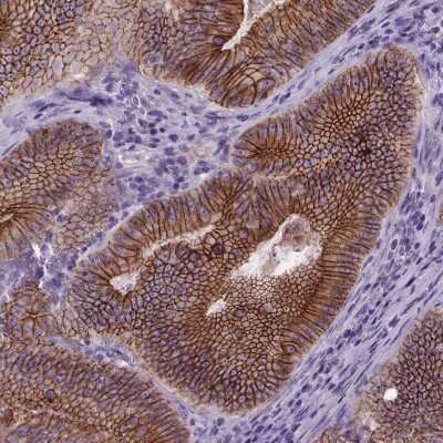 Immunohistochemistry-Paraffin: E-Cadherin Antibody (CL1172) [NBP2-34476]