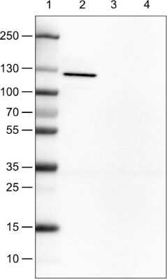 Western Blot: E-Cadherin Antibody (CL1172) [NBP2-34476]