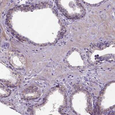 Immunohistochemistry-Paraffin: E-Cadherin Antibody (CL1180) [NBP2-34477]
