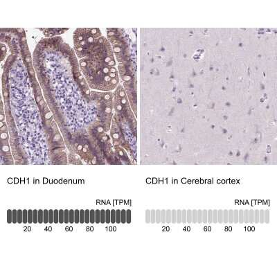 Immunohistochemistry-Paraffin: E-Cadherin Antibody (CL1180) [NBP2-34477]
