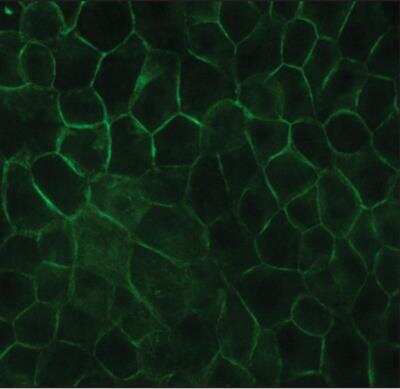 Immunocytochemistry/ Immunofluorescence: E-Cadherin Antibody (DECMA-1) [NB120-11512]