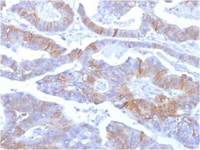 Immunohistochemistry-Paraffin: E-Cadherin Antibody (SPM381) [NBP2-53230]