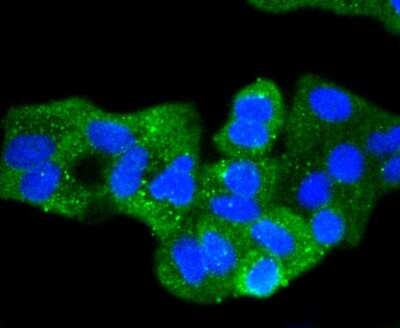 Immunocytochemistry/ Immunofluorescence: E-Cadherin Antibody (ST54-01) [NBP2-67540]