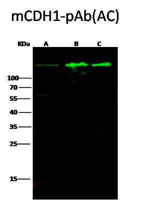 Western Blot: E-Cadherin Antibody [NBP2-98336]