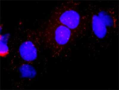 Proximity Ligation Assay: E2F-1 Antibody (2E10) [H00001869-M01]