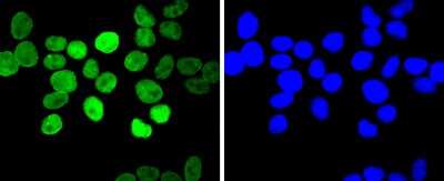 Immunocytochemistry/ Immunofluorescence: E2F-1 Antibody (JJ092-02) [NBP2-67899]