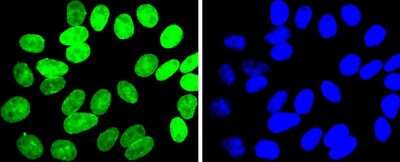 Immunocytochemistry/ Immunofluorescence: E2F-1 Antibody (JJ092-02) [NBP2-67899]