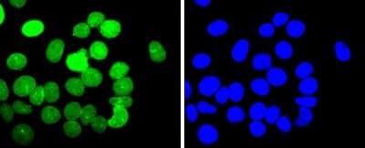 Immunocytochemistry/ Immunofluorescence: E2F-1 Antibody (JJ092-02) [NBP2-67899]