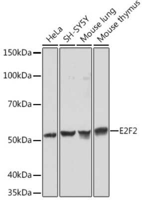 Western Blot: E2F-2 Antibody (1H7D6) [NBP3-16165]