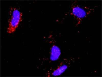 Proximity Ligation Assay: E2F-2 Antibody [H00001870-D01P]