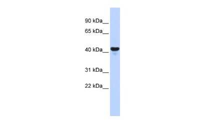Western Blot: E2F-2 Antibody [NBP3-10478]