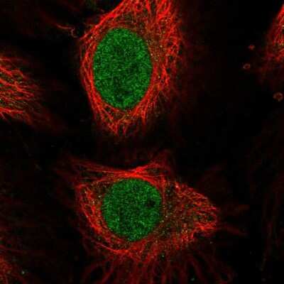 Immunocytochemistry/ Immunofluorescence: E2F-4 Antibody [NBP2-58401]