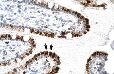 Immunohistochemistry: E2F-4 Antibody [NBP3-10895]