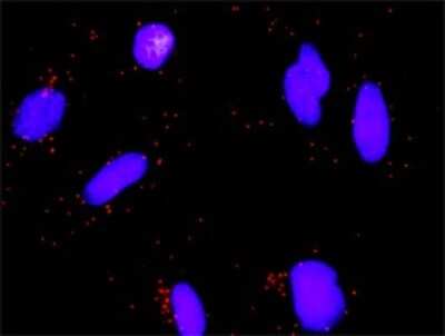 Proximity Ligation Assay: E2F3 Antibody (5F7) [H00001871-M01]