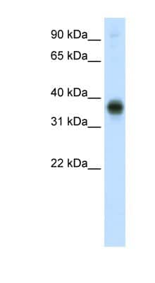Western Blot: E2F3 Antibody [NBP1-80295]