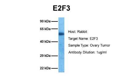 Western Blot: E2F3 Antibody [NBP1-80295]