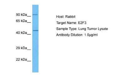 Western Blot: E2F3 Antibody [NBP1-80295]