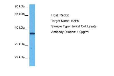 Western Blot: E2F5 Antibody [NBP2-82955]