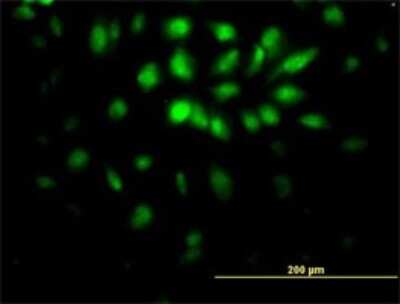 Immunocytochemistry/ Immunofluorescence: E2F6 Antibody (1F7-A9) [H00001876-M02]