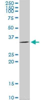 Western Blot: E2F6 Antibody (1F7-A9) [H00001876-M02]