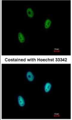 Immunocytochemistry/ Immunofluorescence: E2F6 Antibody [NBP2-14936]