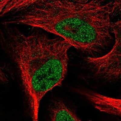 Immunocytochemistry/ Immunofluorescence: E2F6 Antibody [NBP2-69000]