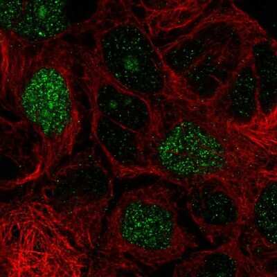 Immunocytochemistry/ Immunofluorescence: E2F8 Antibody [NBP2-57373]