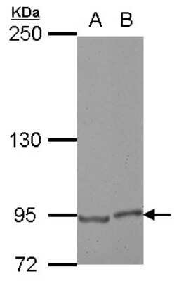 Western Blot: E2F8 Antibody [NBP2-16252]