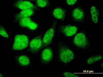 Immunocytochemistry/ Immunofluorescence: E4F1 Antibody (4B10) [H00001877-M03]