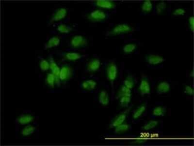 Immunocytochemistry/ Immunofluorescence: E6AP/UBE3A Antibody (2F6) [H00007337-M01]
